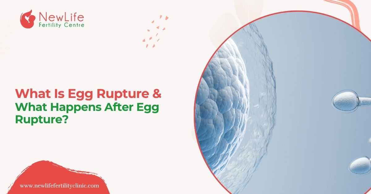 What Is Egg Rupture & What Happens After Egg Rupture?