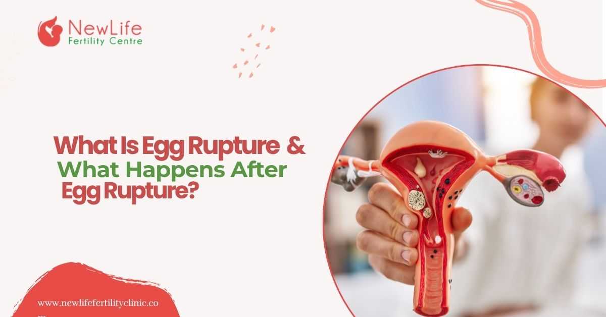 What Is Egg Rupture & What Happens After Egg Rupture?