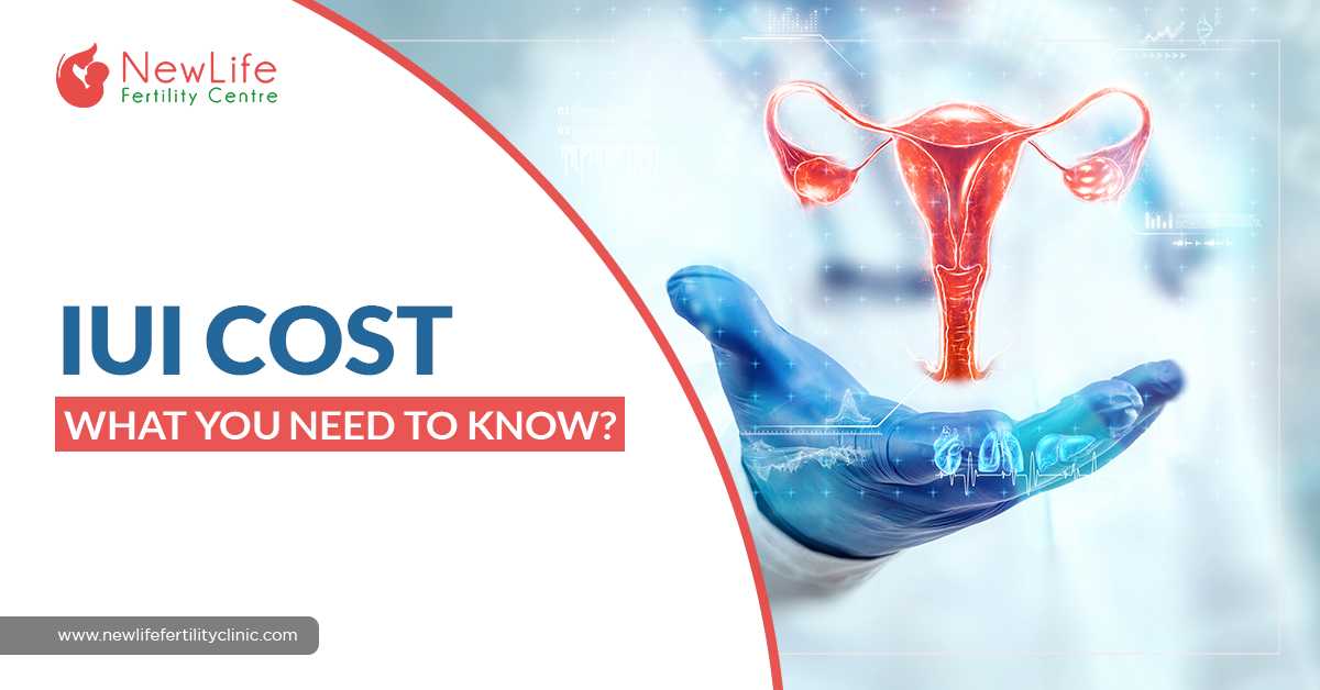 IUI Cost – What You Need To Know