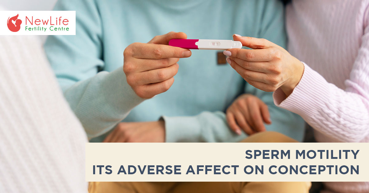 Sperm Motility- Its Adverse Affect on Conception