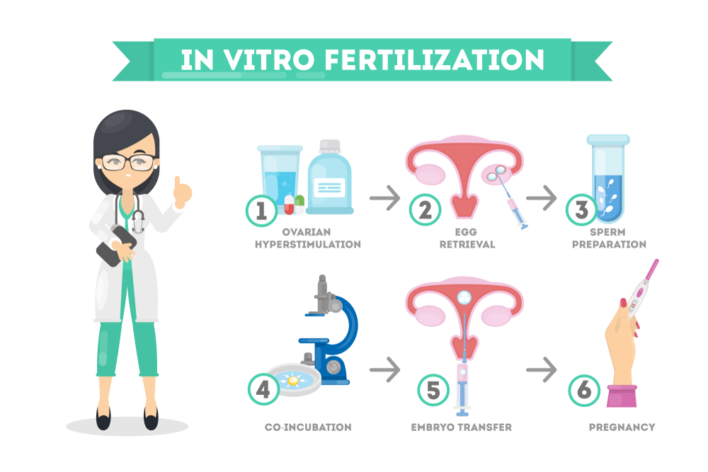 Find Out Everything You Need to Know About IVF Treatment