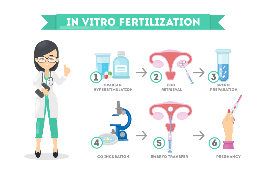 Ivf Procedure