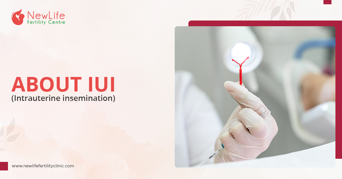 Lets understand all about IUI (Intrauterine insemination)