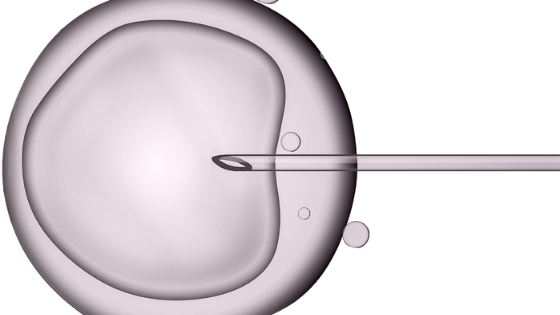 IVF Treatment