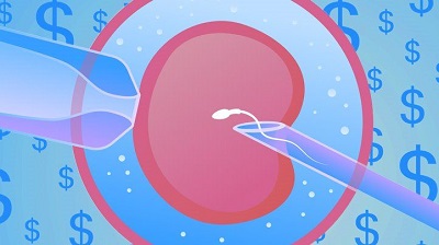 IVF technology-In Vitro Fertilization