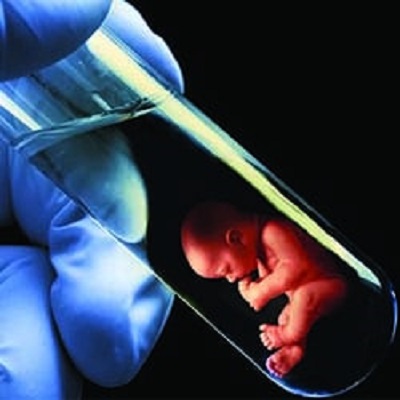 test tube baby