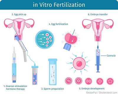 cope up with ivf cycle