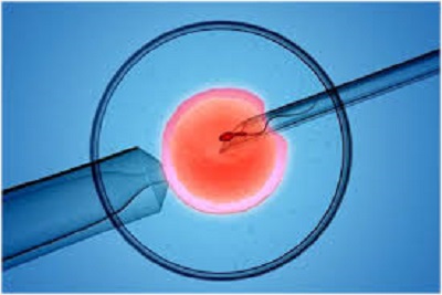 Learn about IVF with the best IVF centre in India