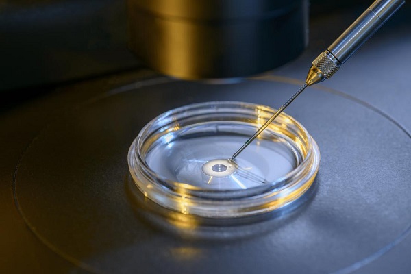 Laboratory Test with low cost of IVF in Siliguri
