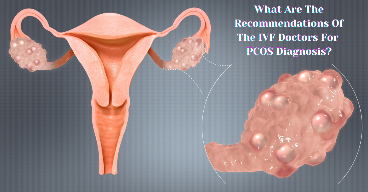recommendations of the IVF doctors for PCOS diagnosis