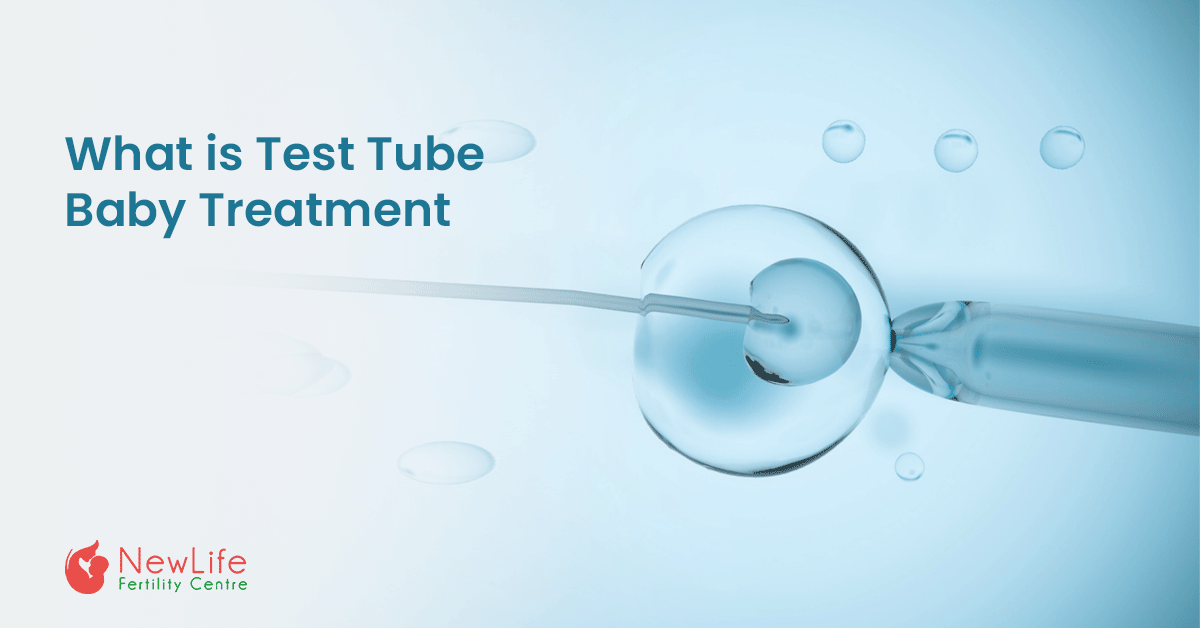 Test Tube Baby Treatment