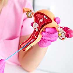 IUI (Intrauterine Insemination)