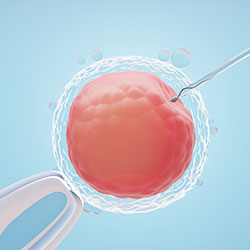 Laser Assisted Hatching