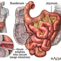 Endoscopic procedures