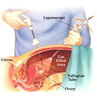 Advanced Laparoscopy