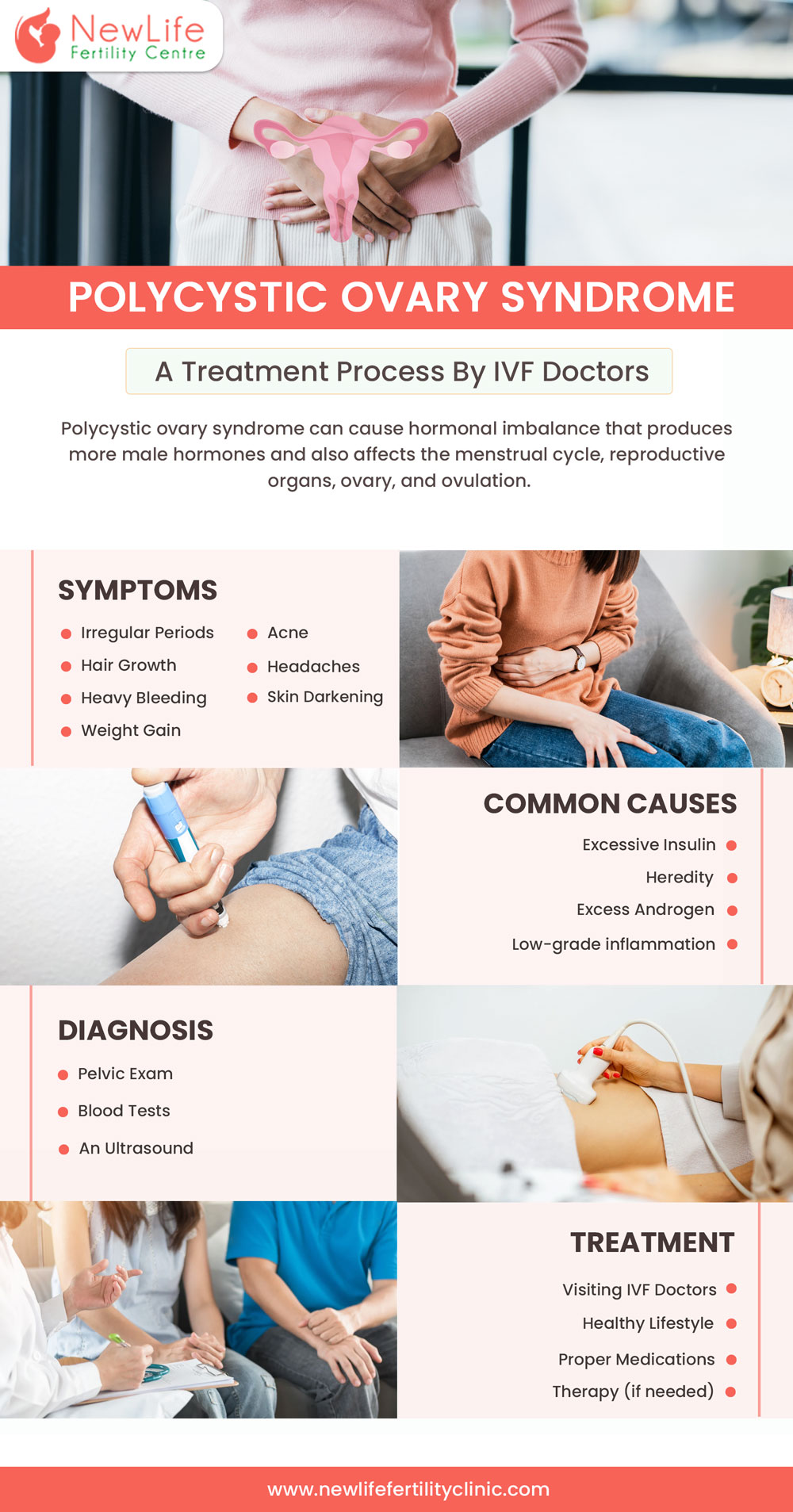 Polycystic Ovary Syndrome (PCOS)