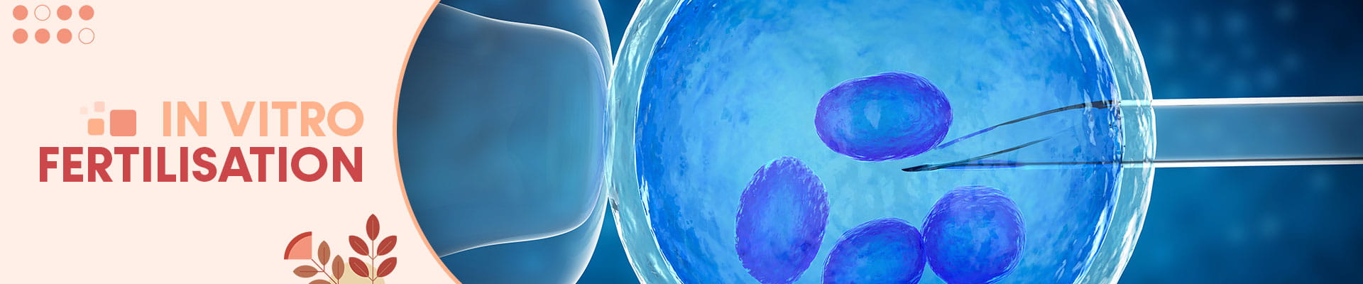 In Vitro Fertilisation(IVF)