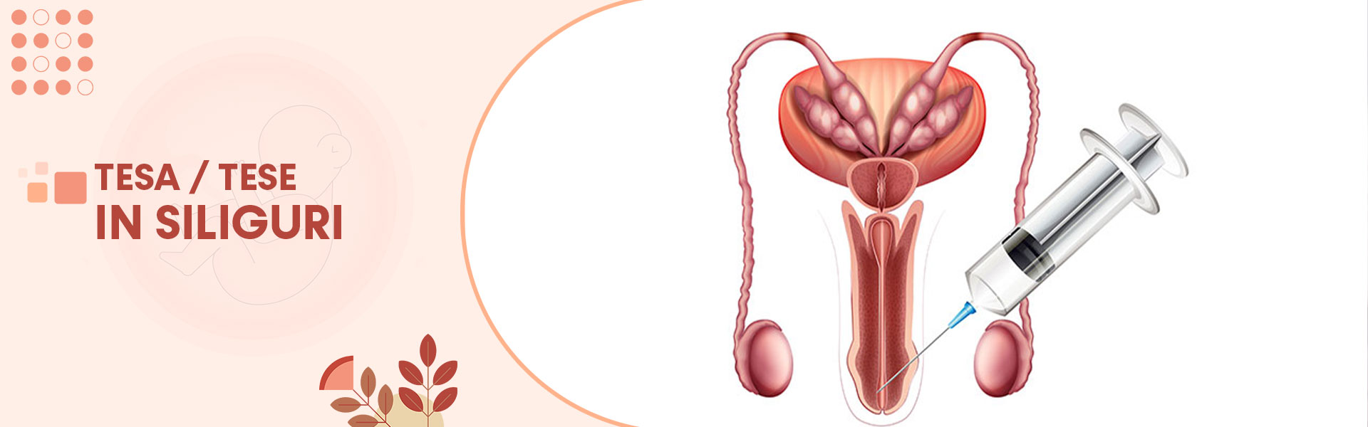 Tesa Tese Treatment Male Infertility