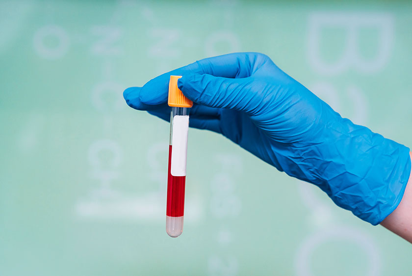 AMH Test in Siliguri
