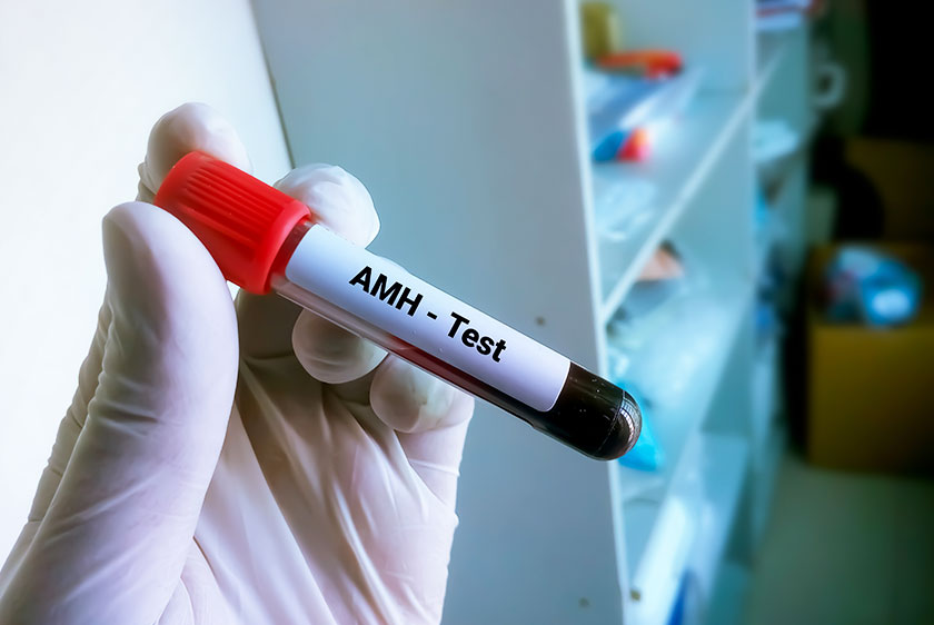 AMH Test