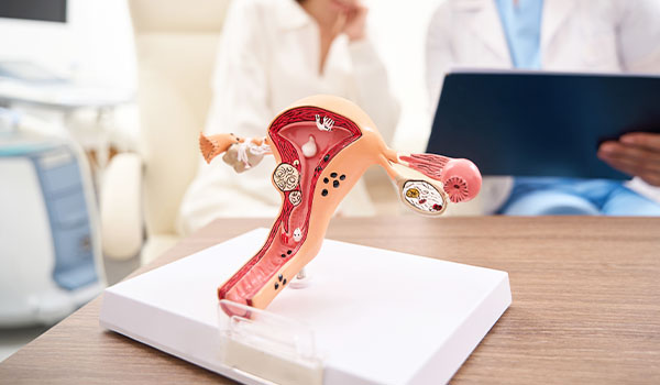 Blocked or Damaged Fallopian Tubes