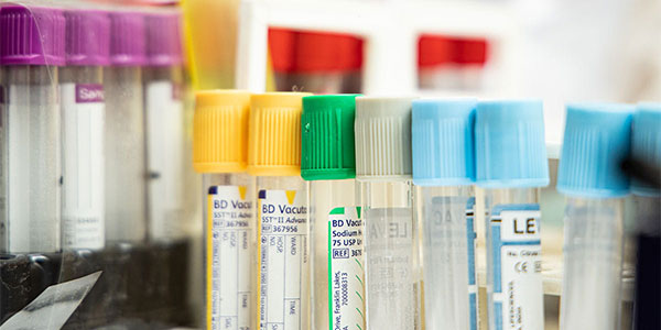 Density gradient centrifugation