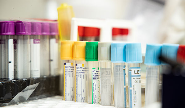 Sperm DNA Fragmentation Index (DFI)