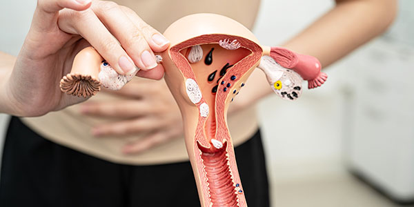 Ectopic Pregnancy