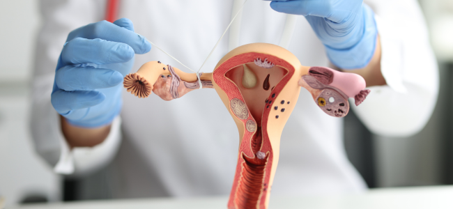 Blockage in the fallopian tubes