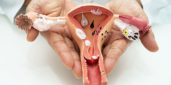 Infection