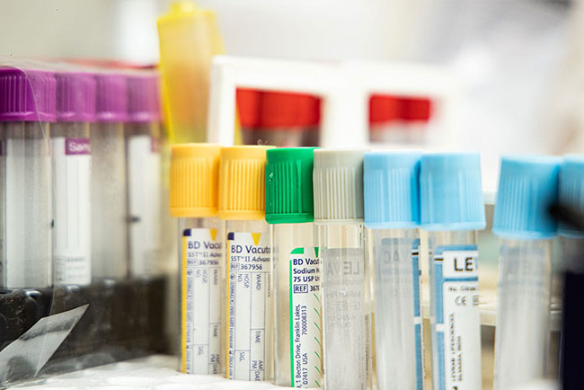 Pre-implantation genetic screening (PGS)