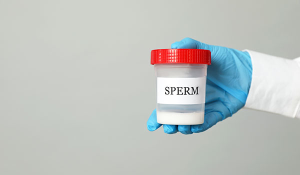 Sperm Collection