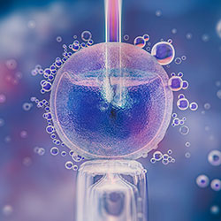 ICSI (Intracytoplasmic Sperm Injection)