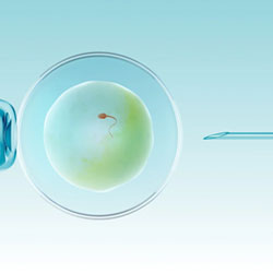 laser Assisted Hatching