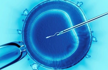 Intracytoplasmic Sperm Injection(ICSI)